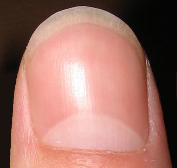 Lunula:
The white, crescent part at the root of the nail