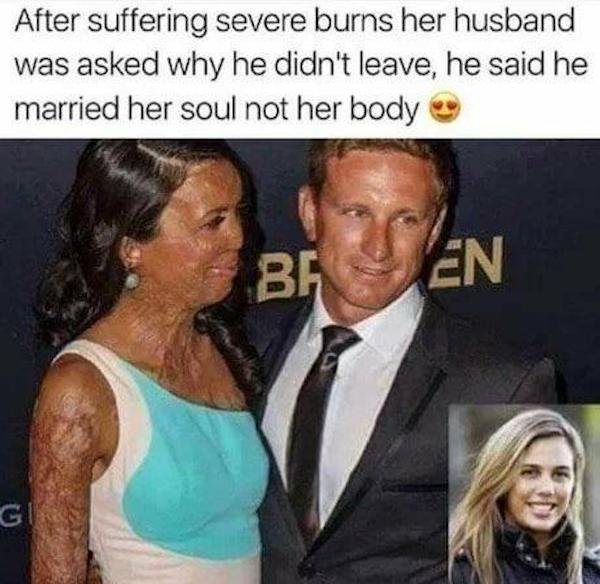 turia pitt and husband - After suffering severe burns her husband was asked why he didn't leave, he said he married her soul not her body Ba En Gi