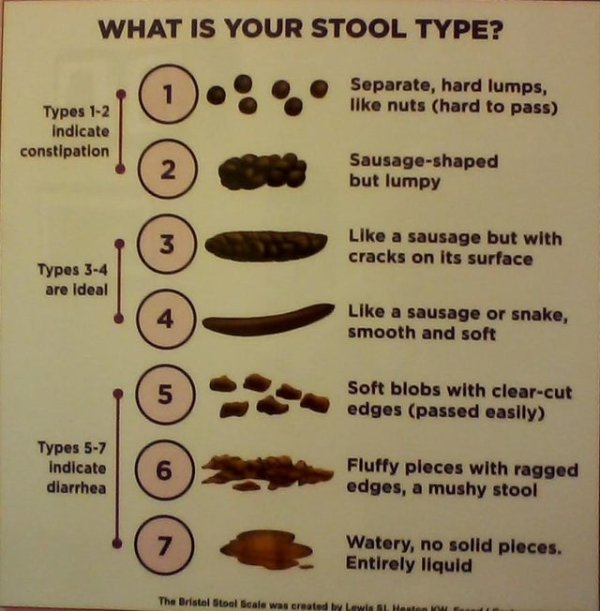 ribbon shaped stool in dogs - What Is Your Stool Type? 1 Separate, hard lumps, nuts hard to pass Types 12 Indicate constipation 2 Sausageshaped but lumpy 3 a sausage but with cracks on its surface Types 34 are Ideal 4 a sausage or snake, smooth and soft 5