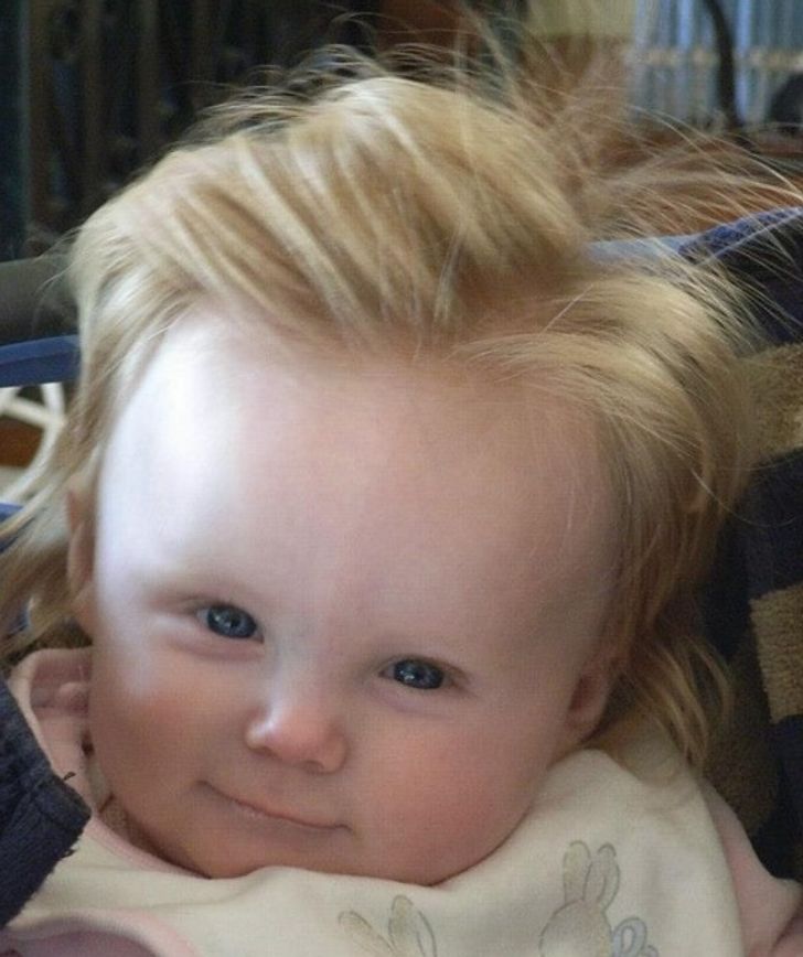 “My friend’s baby was born with Conan O’Brien’s hair!”