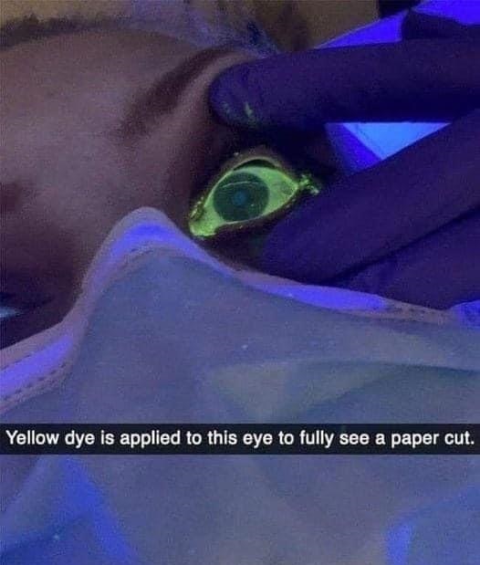 cobalt blue - Yellow dye is applied to this eye to fully see a paper cut.