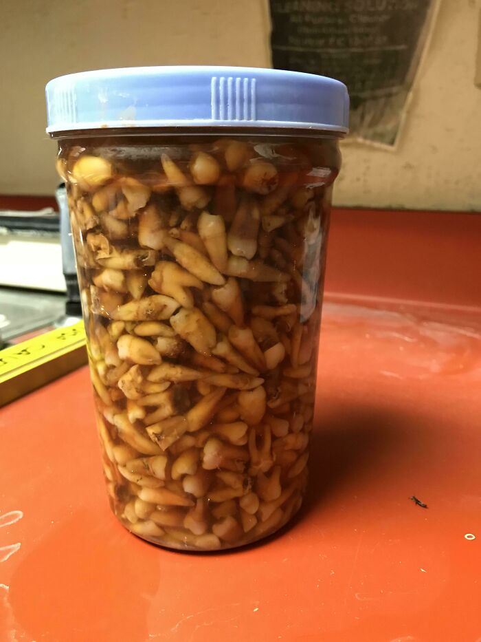 Jar Of Teeth I Found In An Abandoned Dentist Office