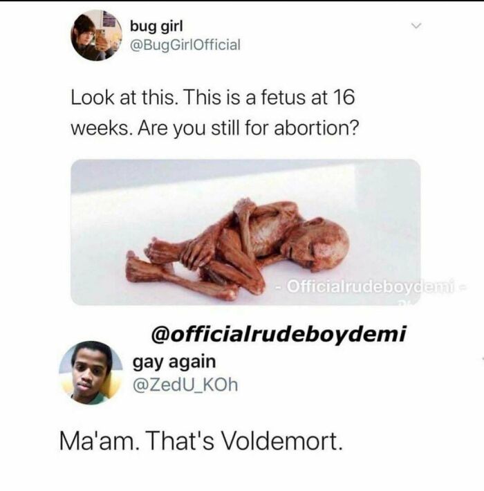 voldemort fetus - bug girl GirlOfficial Look at this. This is a fetus at 16 weeks. Are you still for abortion? Officialrudeboydemi gay again Ma'am. That's Voldemort.