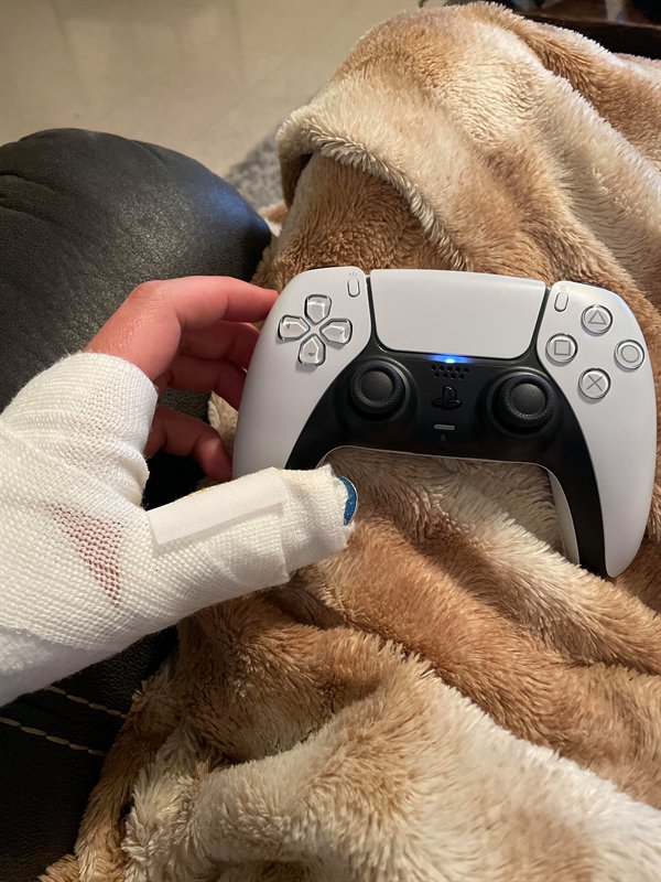 “PS5 gets delivered today and I just happen to break my thumb.”