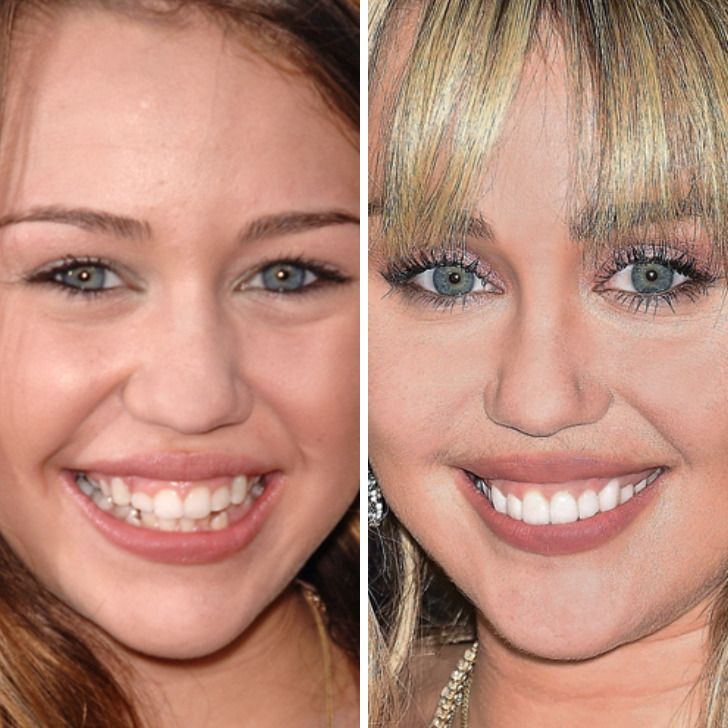 Miley Cyrus,
Age 13 vs age 26