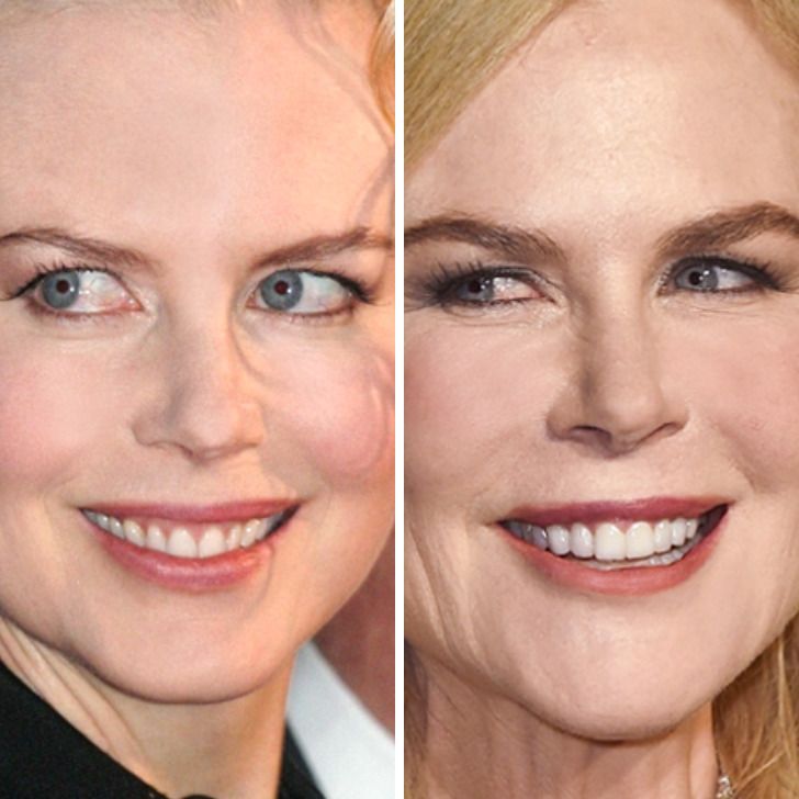 Nicole Kidman,
Age 37 vs age 52