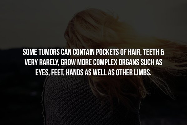 let it go - Some Tumors Can Contain Pockets Of Hair, Teeth & Very Rarely, Grow More Complex Organs Such As Eyes, Feet, Hands As Well As Other Limbs.