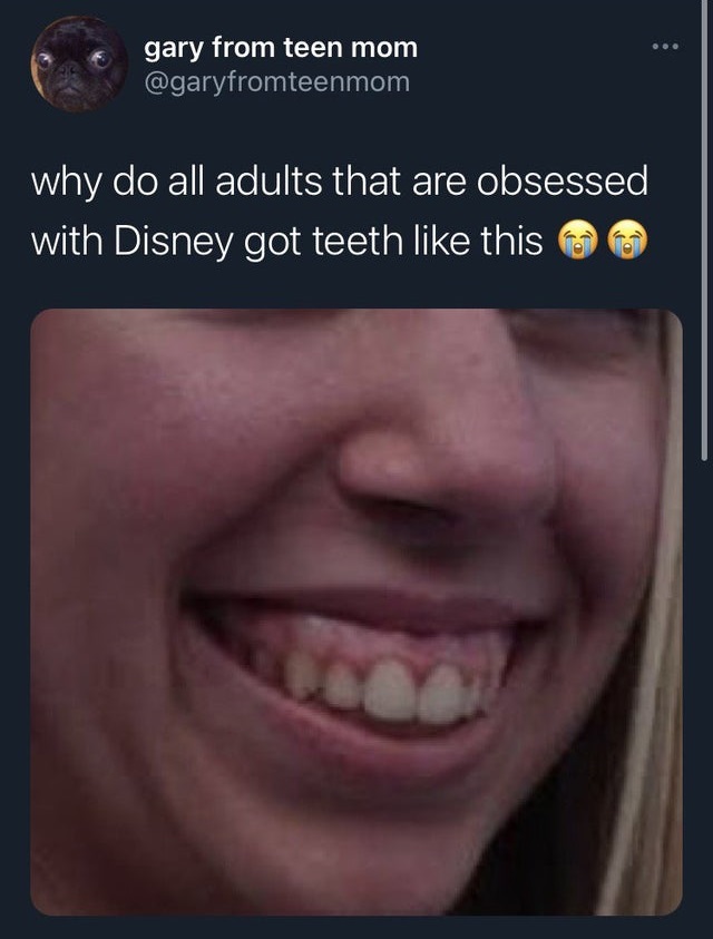 lip - gary from teen mom why do all adults that are obsessed with Disney got teeth this