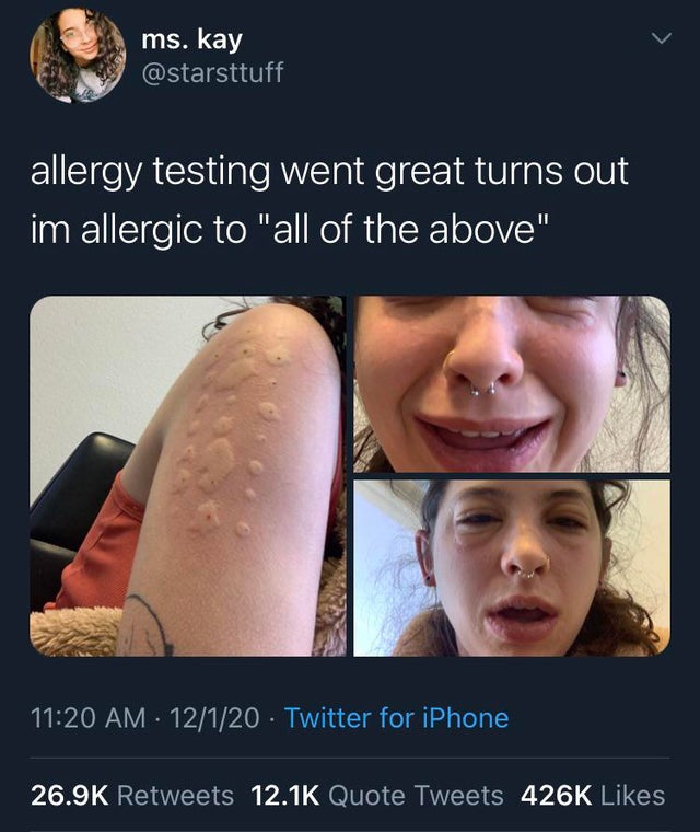 jaw - ms. kay allergy testing went great turns out im allergic to "all of the above" 12120 Twitter for iPhone Quote Tweets