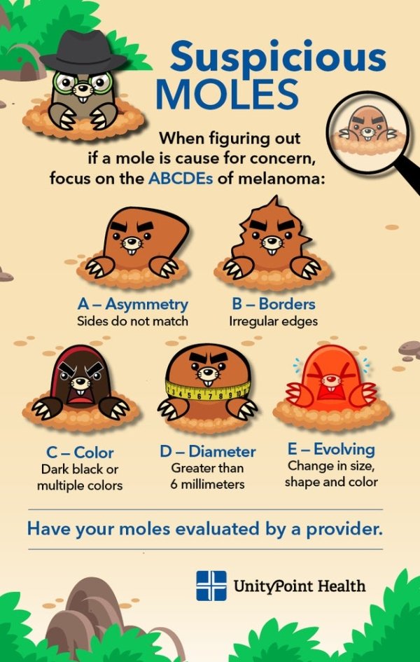 interesting facts - moles formed - Suspicious Moles When figuring out if a mole is cause for concern, focus on the ABCDEs of melanoma A Asymmetry Sides do not match BBorders Irregular edges C Color Dark black or multiple colors D Diameter Greater than 6 m