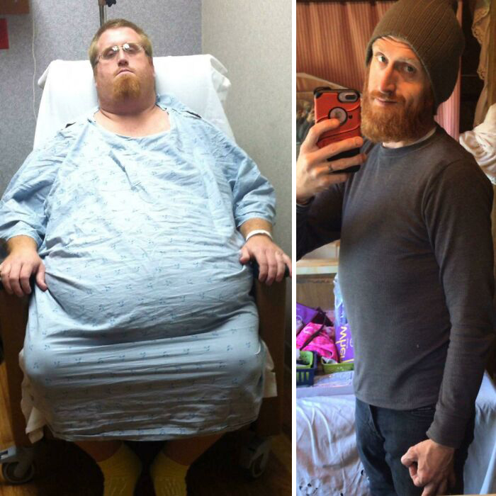 150 lbs weight loss -