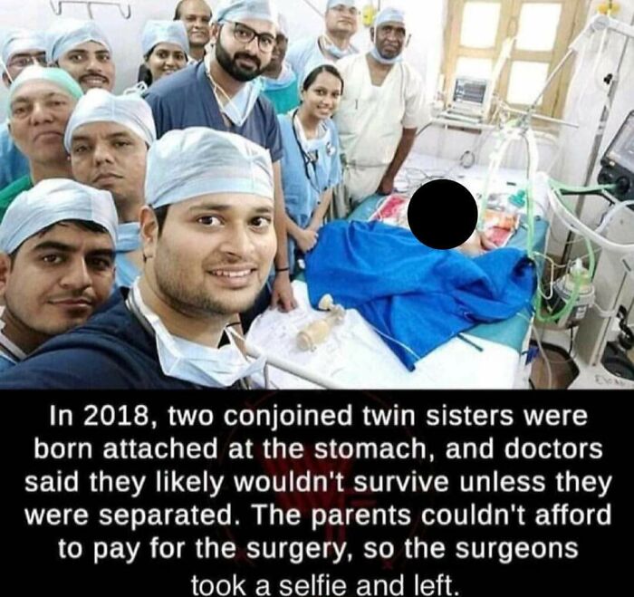 2018 two conjoined twins - In 2018, two conjoined twin sisters were born attached at the stomach, and doctors said they ly wouldn't survive unless they were separated. The parents couldn't afford to pay for the surgery, so the surgeons took a selfie and l