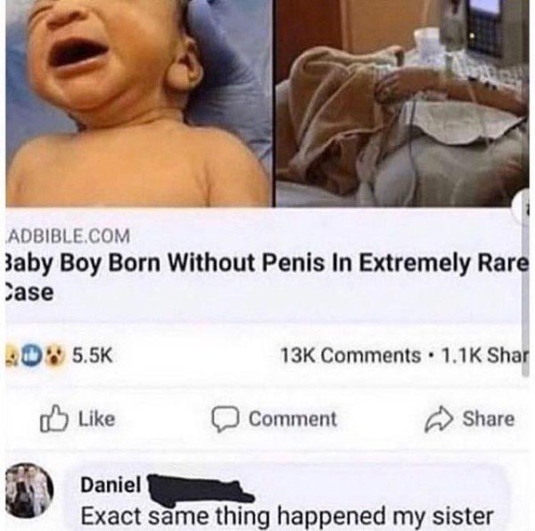technically correct - baby born without penis - Adbible.Com Baby Boy Born Without Penis In Extremely Rare Case 20% 13K Shar Comment Daniel Exact same thing happened my sister