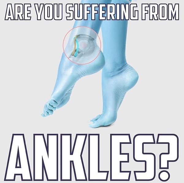 you suffering from ankles meme - Are You Suffering From Ankles?