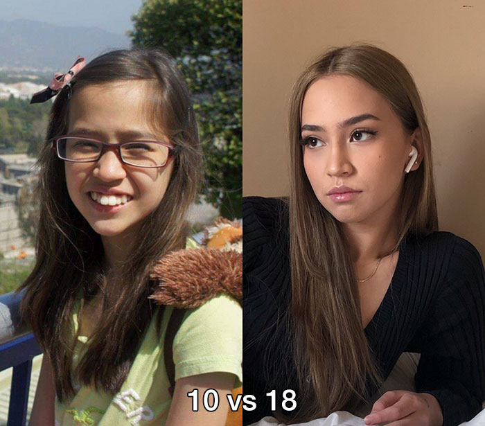 puberty glow ups - 10 vs 18