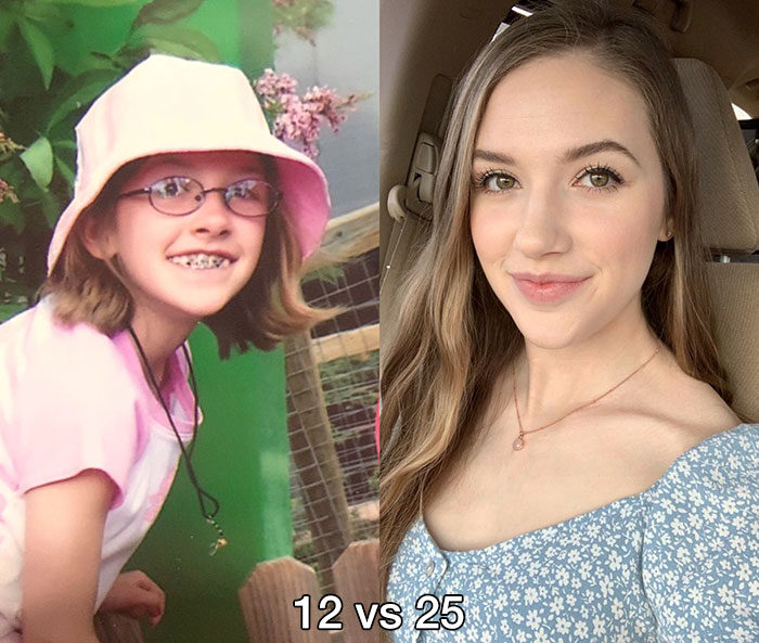 r uglyduckling - 12 vs 25