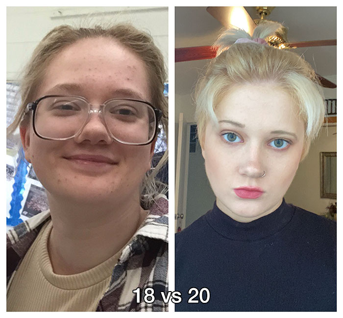 18 Vs 20