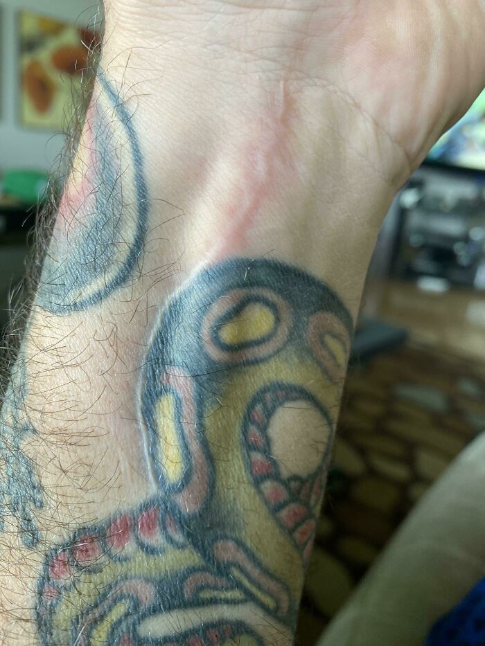wholesome pics - photo of wrist tattoo with surgery scar