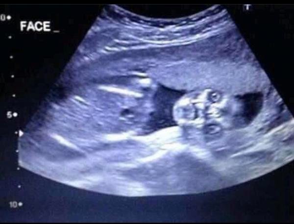 creepy ultrasound - 0. Face 10.