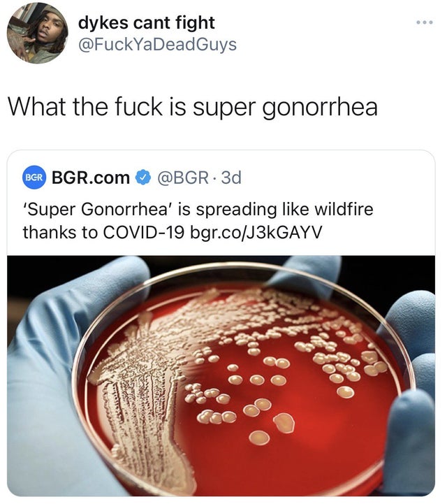 dykes cant fight What the fuck is super gonorrhea Ber Bgr.com . 3d 'Super Gonorrhea' is spreading wildfire thanks to Covid19 bgr.coJ3kGAYV Usd