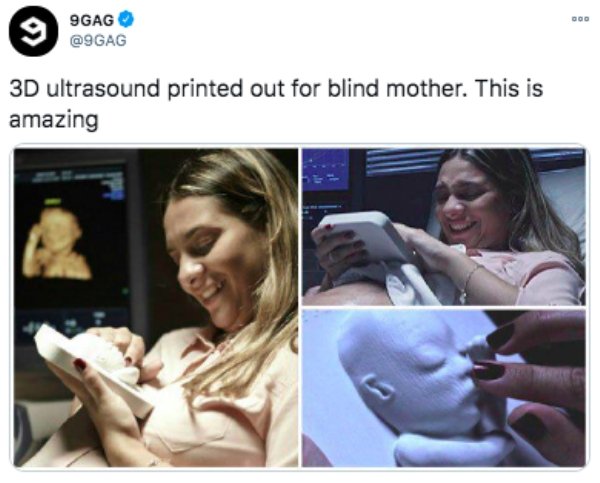 3d ultrasound for blind mother - Doo 9GAG 3D ultrasound printed out for blind mother. This is amazing