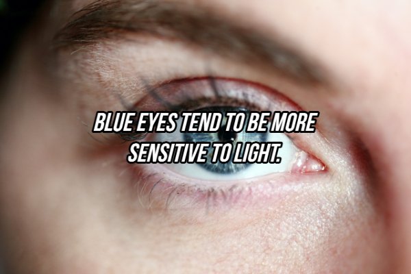 Blue Eyes Tend To Be More Sensitive To Light
