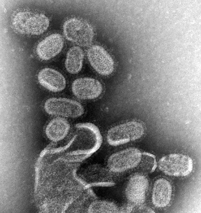 influenza virus electron microscope