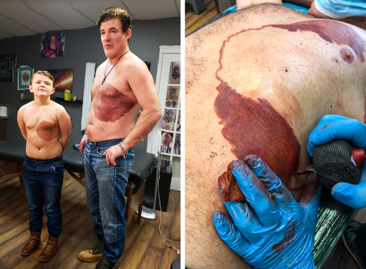 His son had a birthmark on his chest that he doesn’t like. To support him he spent 30 hours getting a matching tattoo.