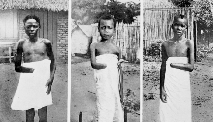 Children of the Belgian Congo circa 1900. If they did not come back with enough rubber for the day, their hands would be chopped off.