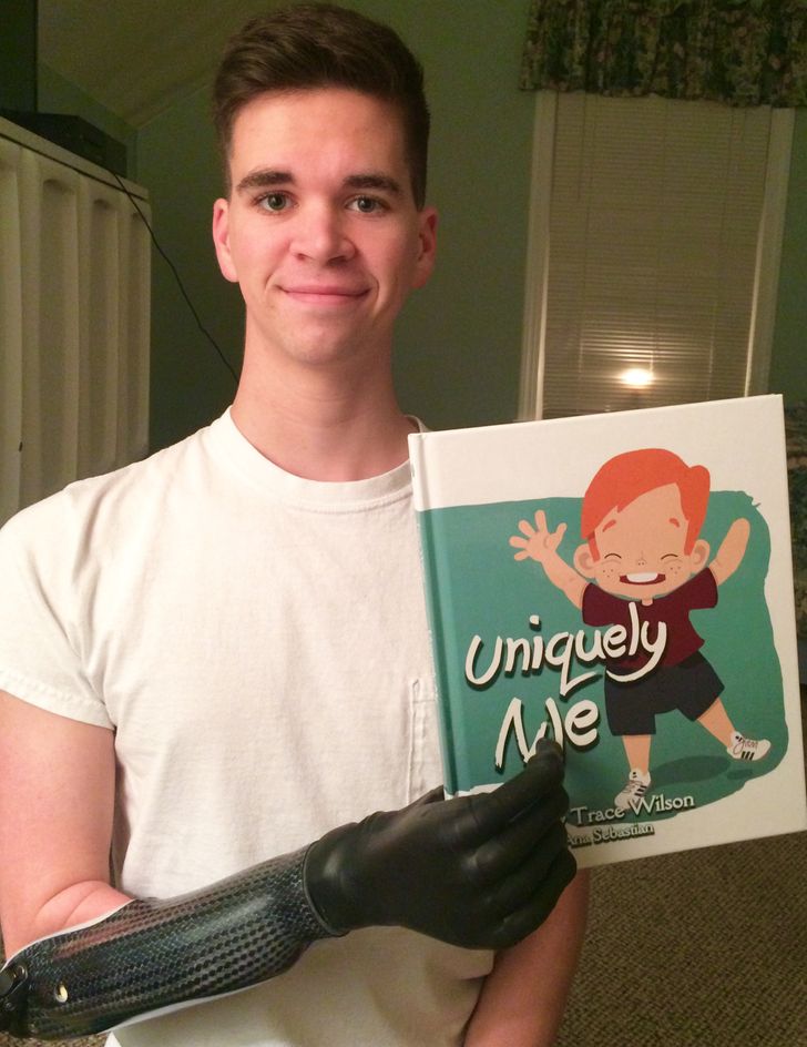 “I recently received a bionic arm, and today I held the children’s book that I wrote with my right hand for the first time!”