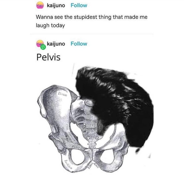funny jokes - pelvic bone - Wanna see the stupidest thing that made me laugh today pelvis elvis presley wig