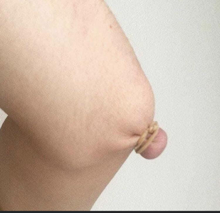 funny memes - knee with rubber band looks like nipple