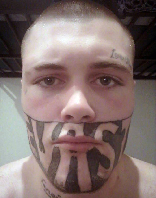 21 People Who Did Horrible Things to Their Face.