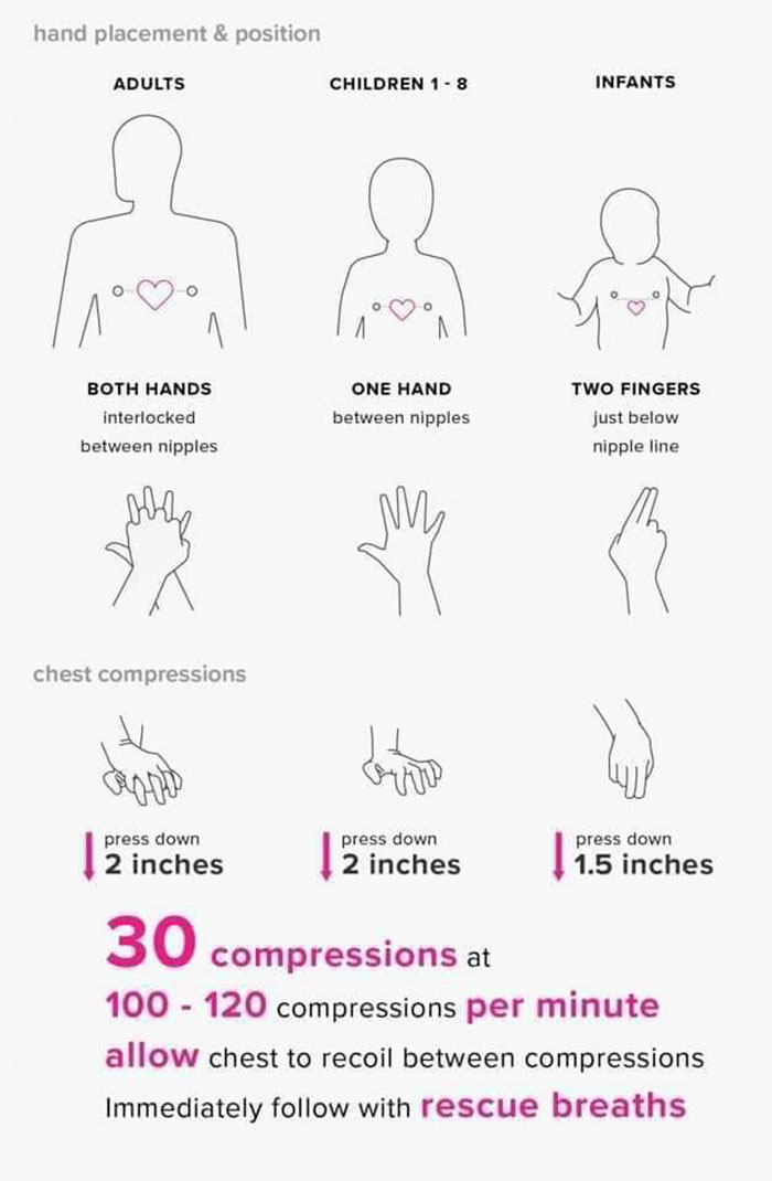 cool infographics - hand placement & position Adults Children 18 Infants Both Hands One Hand between nipples interlocked Two Fingers just below nipple line between nipples my chest compressions Oh press down 2 inches press down 2 inches press down 1.5 inc