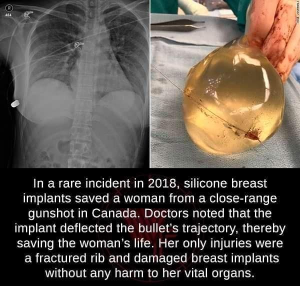 Saved by a boob.