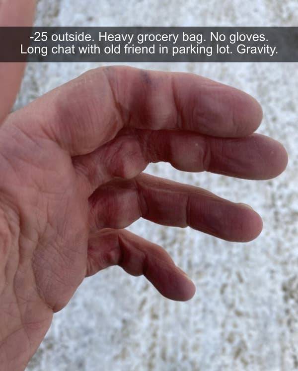 Shopping bag - 25 outside. Heavy grocery bag. No gloves. Long chat with old friend in parking lot. Gravity.