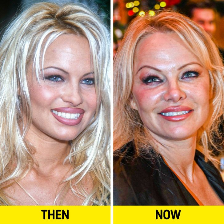 blond - Then Now