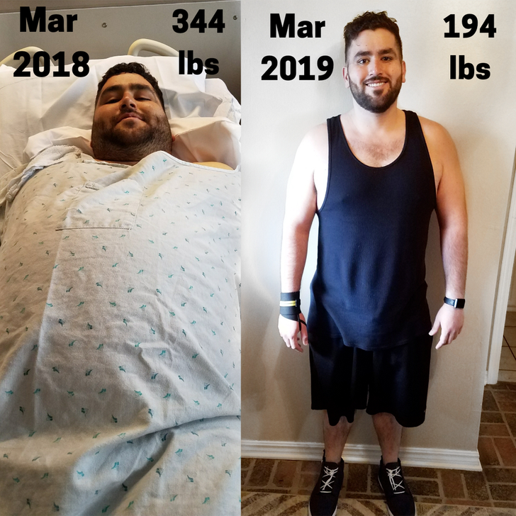 life changes and inspiring stories - liver cirrhosis transplant - 344 Mar lbs 2019 194 lbs