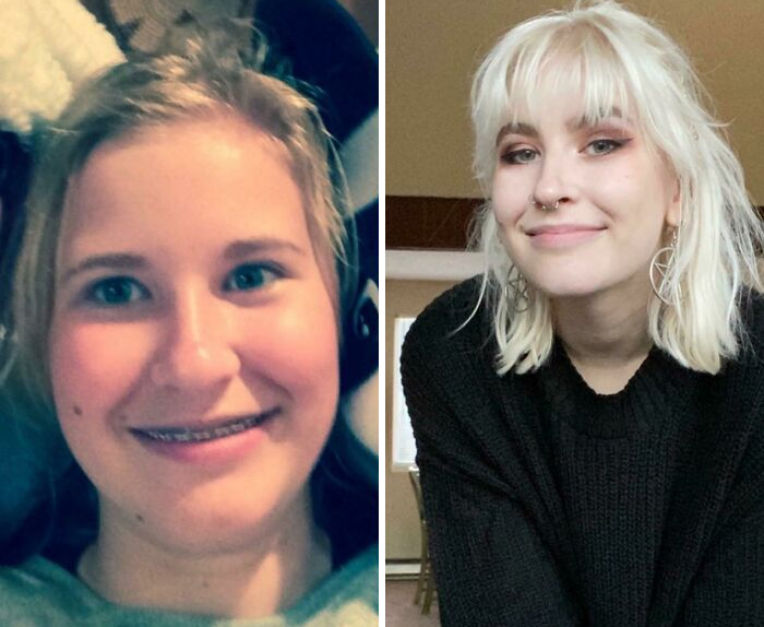 14 To 20 Bc Ppl Said My Resting Face Was Angry