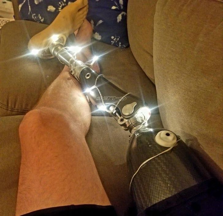 funny sibling pics - prosthetic leg covered in christmas lights