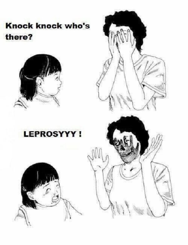 Leprosy.

Leprosy was, sadly, quite common throughout the Middle Ages. Because people didn’t know how to deal with the disease, victims were almost immediately shunned and treated like outcasts- a terrible way to go. The damage of the disease is even evident in the skeletons studied today.