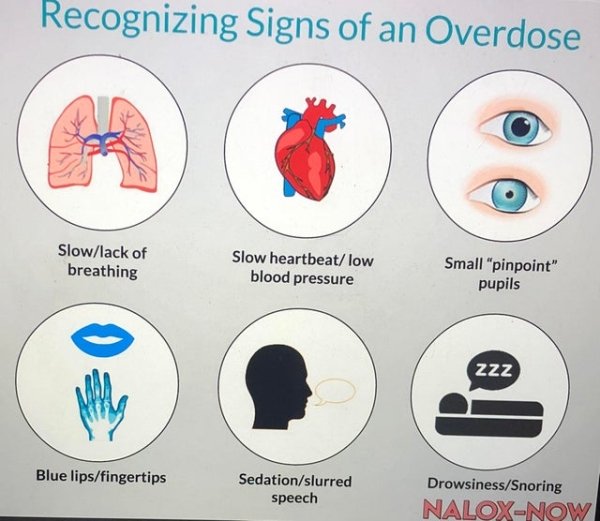 organ - Recognizing Signs of an Overdose Slowlack of breathing Slow heartbeatlow blood pressure Small "pinpoint" pupils Zzz Blue lipsfingertips Sedationslurred speech DrowsinessSnoring NaloxNow