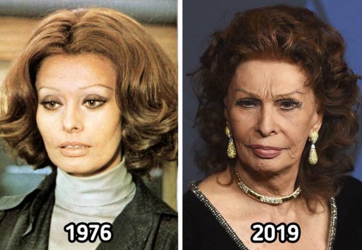 celebrities now and then - head - 1976 2009
