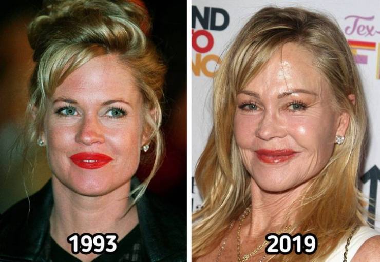 celebrities now and then - lip - Ind so Tex 1993 2019