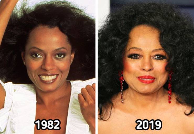 celebrities now and then - lip - 1982 2009