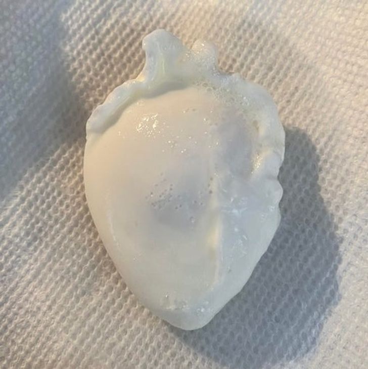 “One of the eggs I poached this morning came out looking like a human heart.”