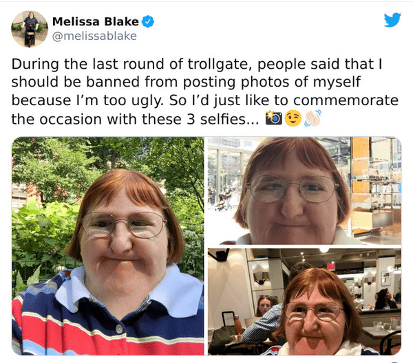 melissa blake - Melissa Blake During the last round of trollgate, people said that I should be banned from posting photos of myself because I'm too ugly. So I'd just to commemorate the occasion with these 3 selfies... o
