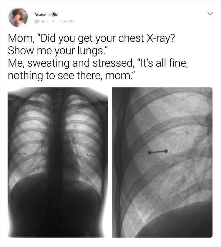 Sometimes, X-rays can reveal our secrets.