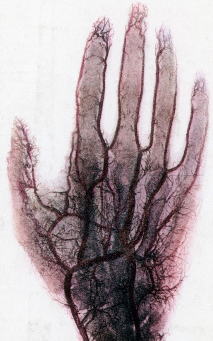 Blood vessels in a hand