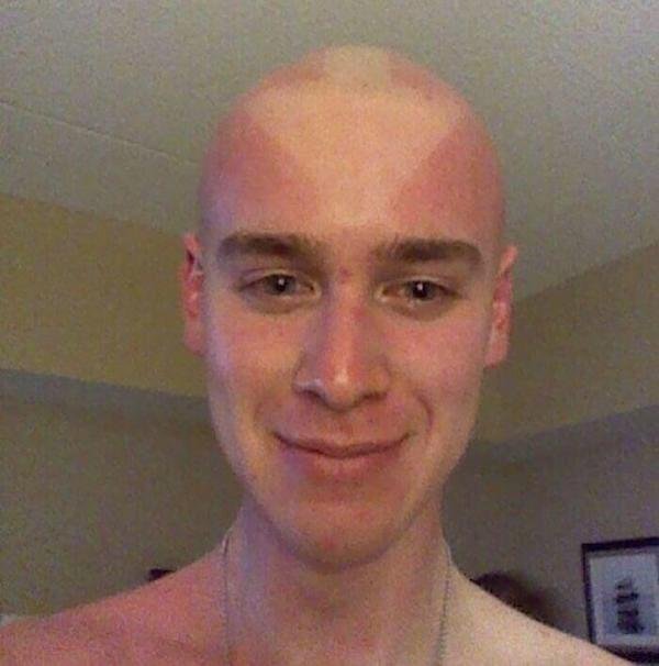 funny pics -- guy with airbender sunburn hairstyle tan lines